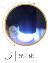 儿童口腔窝沟封闭流程五