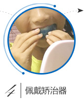 德贝美口腔牙齿矫正流程四