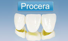 瑞典Procera氧化锆美牙冠