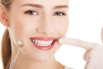 牙齿美白瓷贴面多少钱(图1)