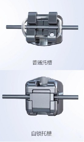 金属矫正和金属自锁区别(图1)