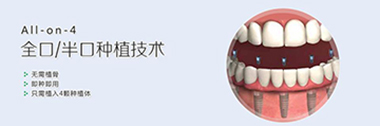 半口缺牙装什么牙好(图1)