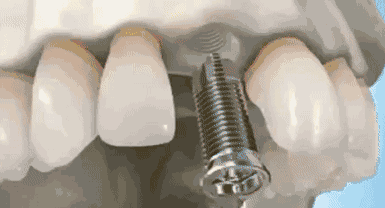 微信图片_20220609170113.gif
